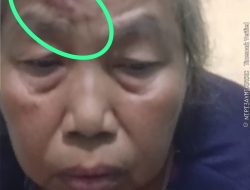 Ibu dan Anak di Tangerang Jadi Korban Pengeroyokan, Pelaku Belum Diamankan