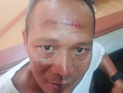 Bantu Selesaikan Persoalan Kecelakaan, Pimpinan Redaksi BantenNet Malah Dianiaya